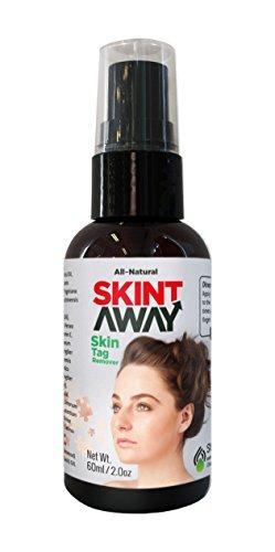 Natural Skin Tag & Mole Remover by Skintaway - 60ml / 2oz